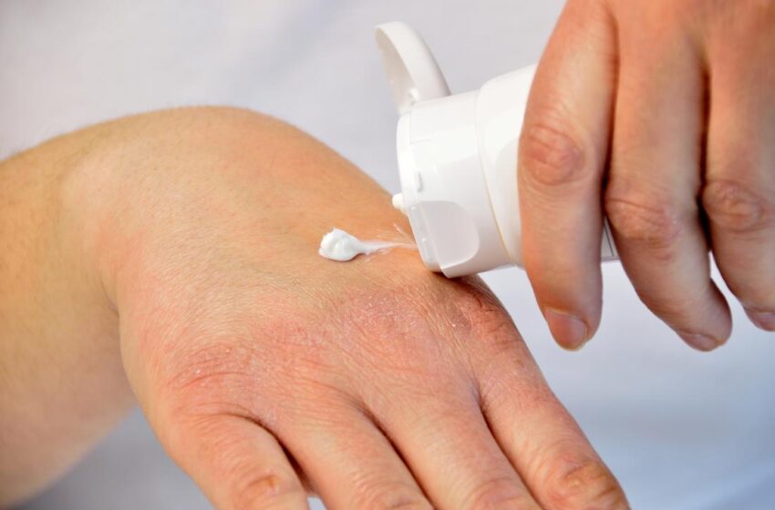 Treatment For Gout And Psoriatic Arthritic Will Improve Your Life