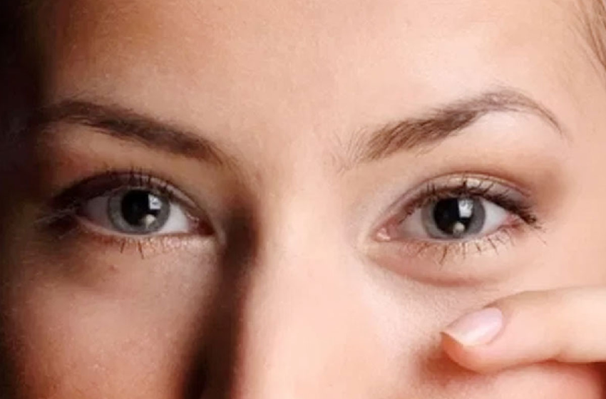 Symptoms and Treatment for Cholesterol Accumulation in the Eyes