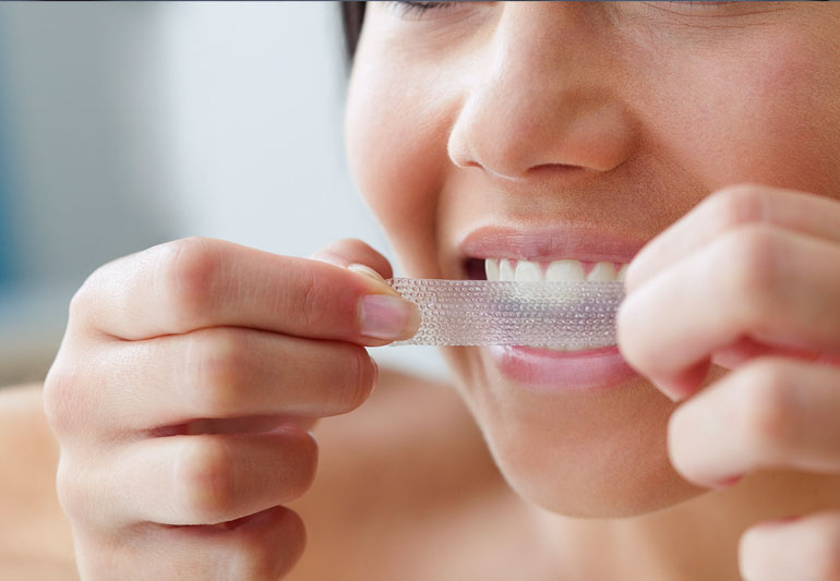  How Long do Teeth Whitening Strips Last?