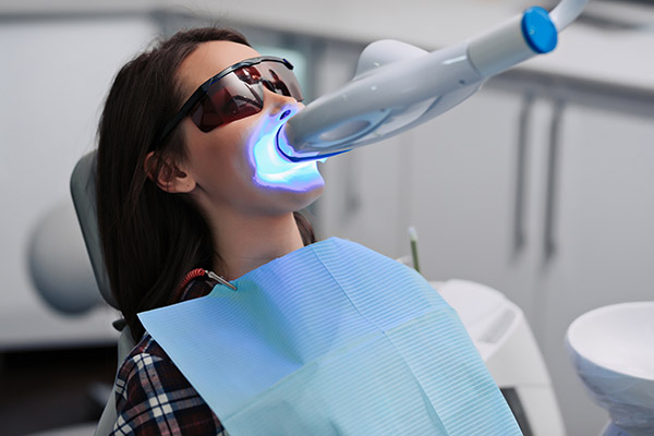  Is It Worth It To Get The Professional Teeth Whitening?